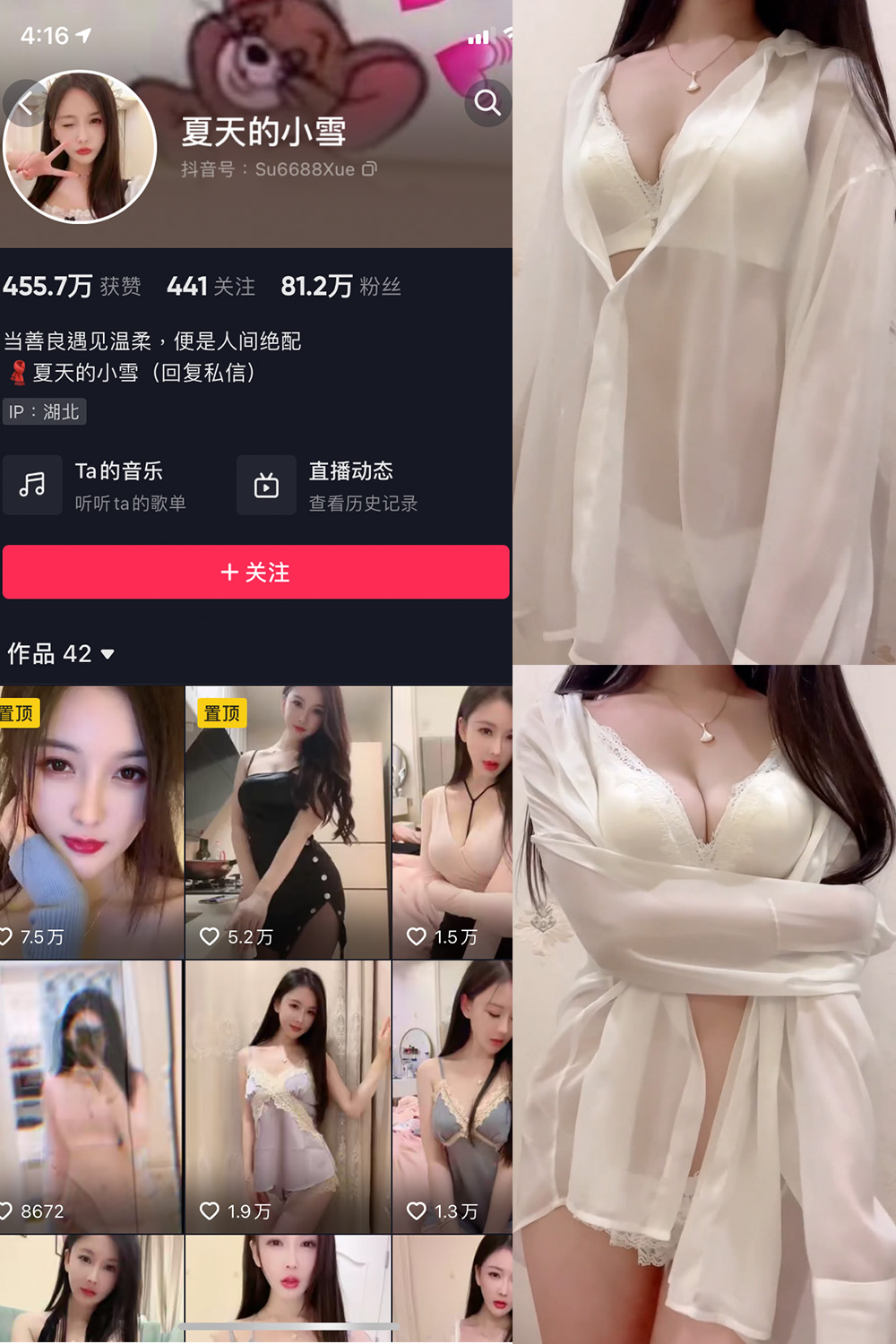抖音 夏天的小雪 微密圈 嘉宾专享 NO.001-011期 最新至：2023.8.11-森女部落